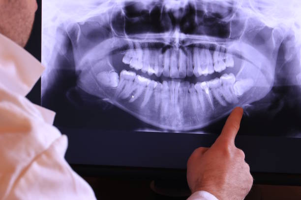 Best Emergency Dentist for Special Needs Patients in Salado, TX