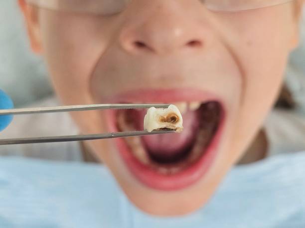 Best Orthodontic Emergency Dentist in Salado, TX